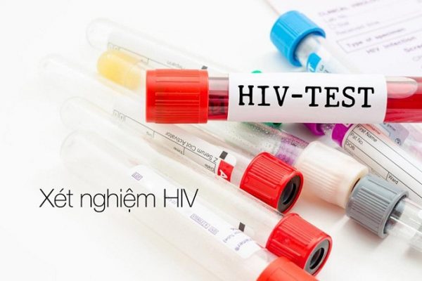 Những điều cần lưu ý khi kiểm tra HIV tại nhà